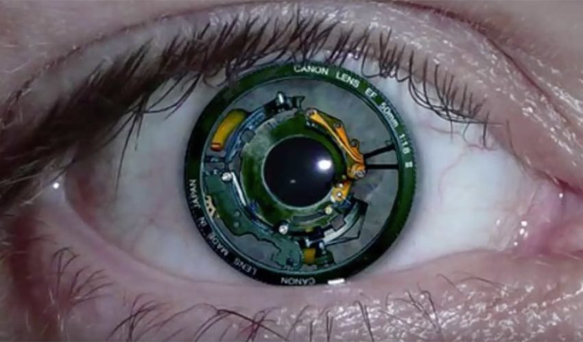 binoic eye implant